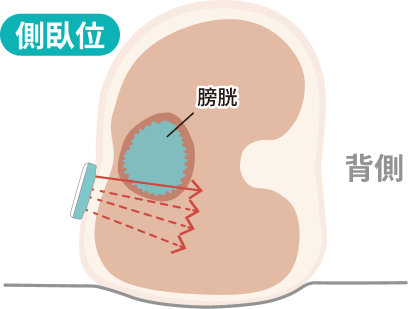 側臥位の姿勢